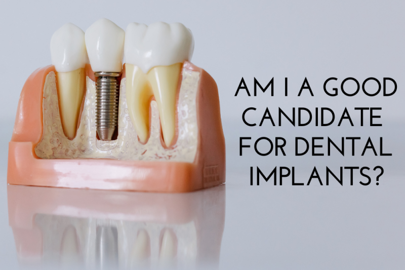 Am I A Good Candidate For Dental Implants
